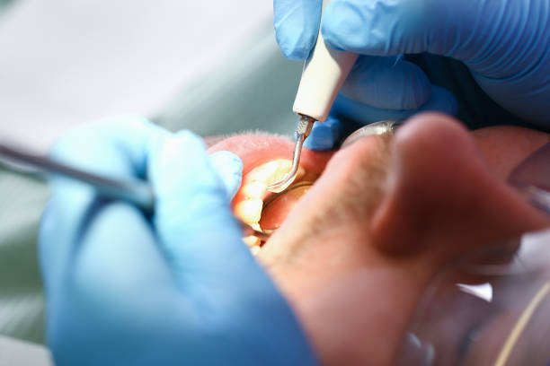 Best Pediatric Emergency Dentist in Luxemburg, WI