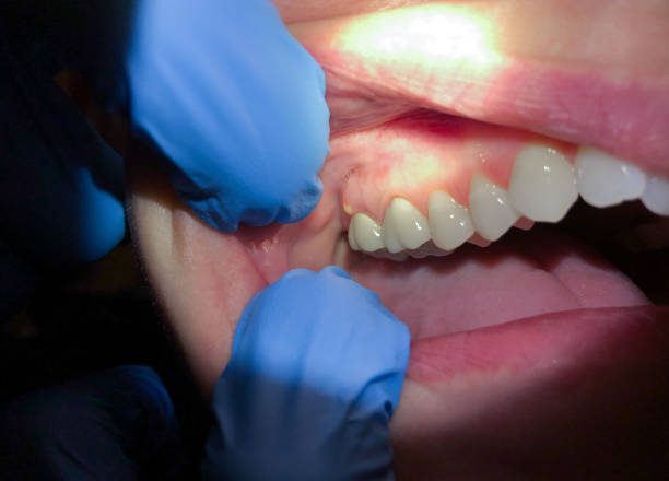 Best Cosmetic Emergency Dentistry in Luxemburg, WI
