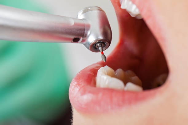 Best Emergency Gum Treatment in Luxemburg, WI